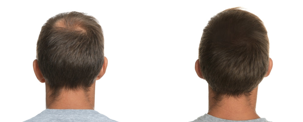 ROSEMARY WATER FOR HAIR GROWTH