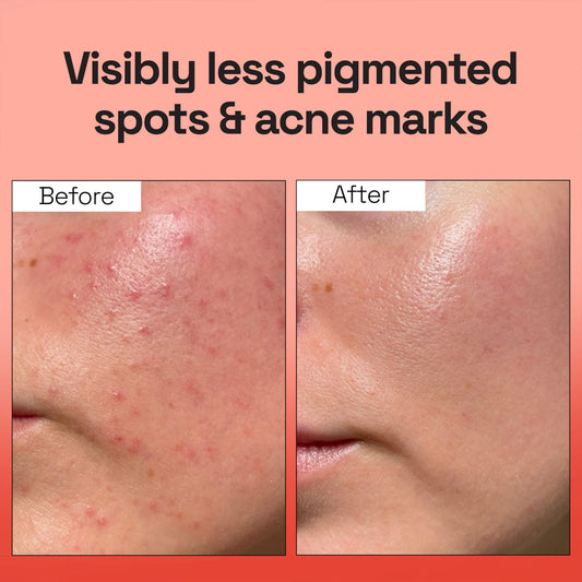 Vegan PDRN Spotless Gel Cleanser