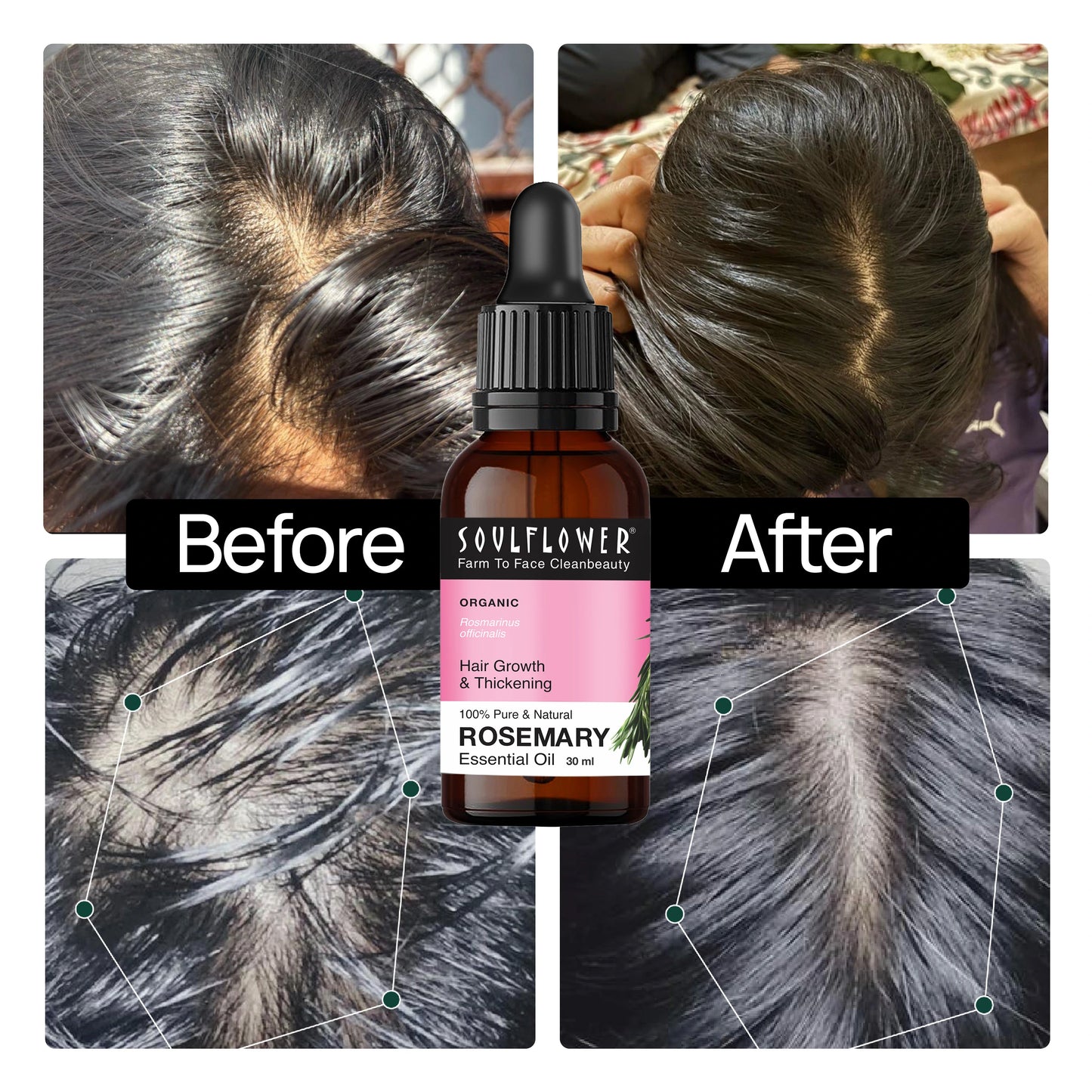 Clinically Tested Rosemary Essential Oil for Hair Growth