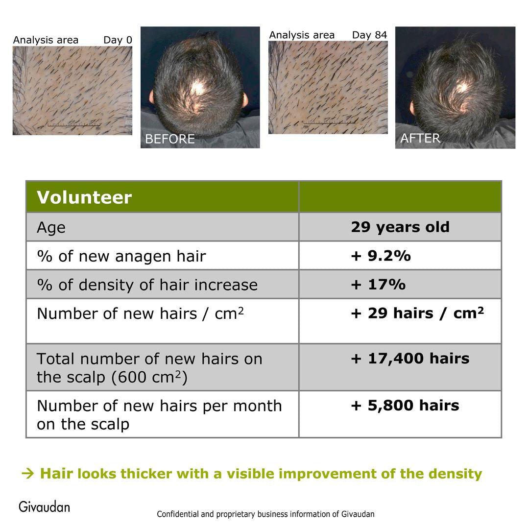 Rosemary Redensyl Hair Growth Serum