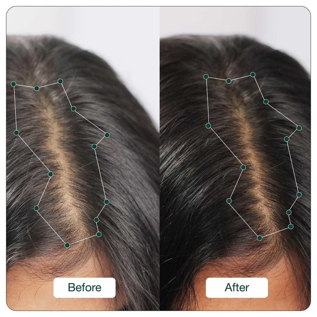 Soulflower 2 Months Hair Growth Booster