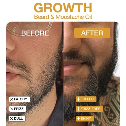 Before and after results using Soulflower Beard & Moustache Oil showing visibly fuller, healthier, and well-groomed beard growth with reduced patchiness.