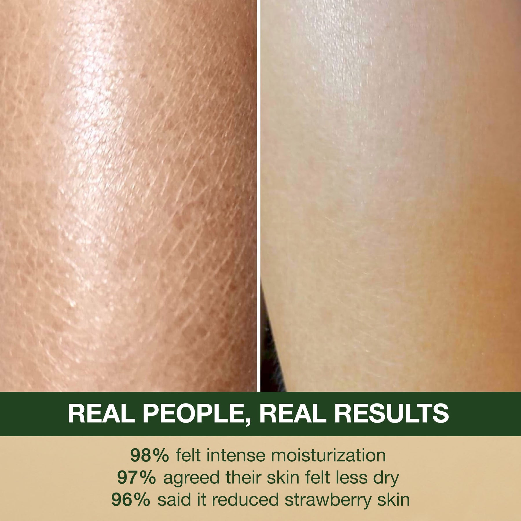 skin Results after apply