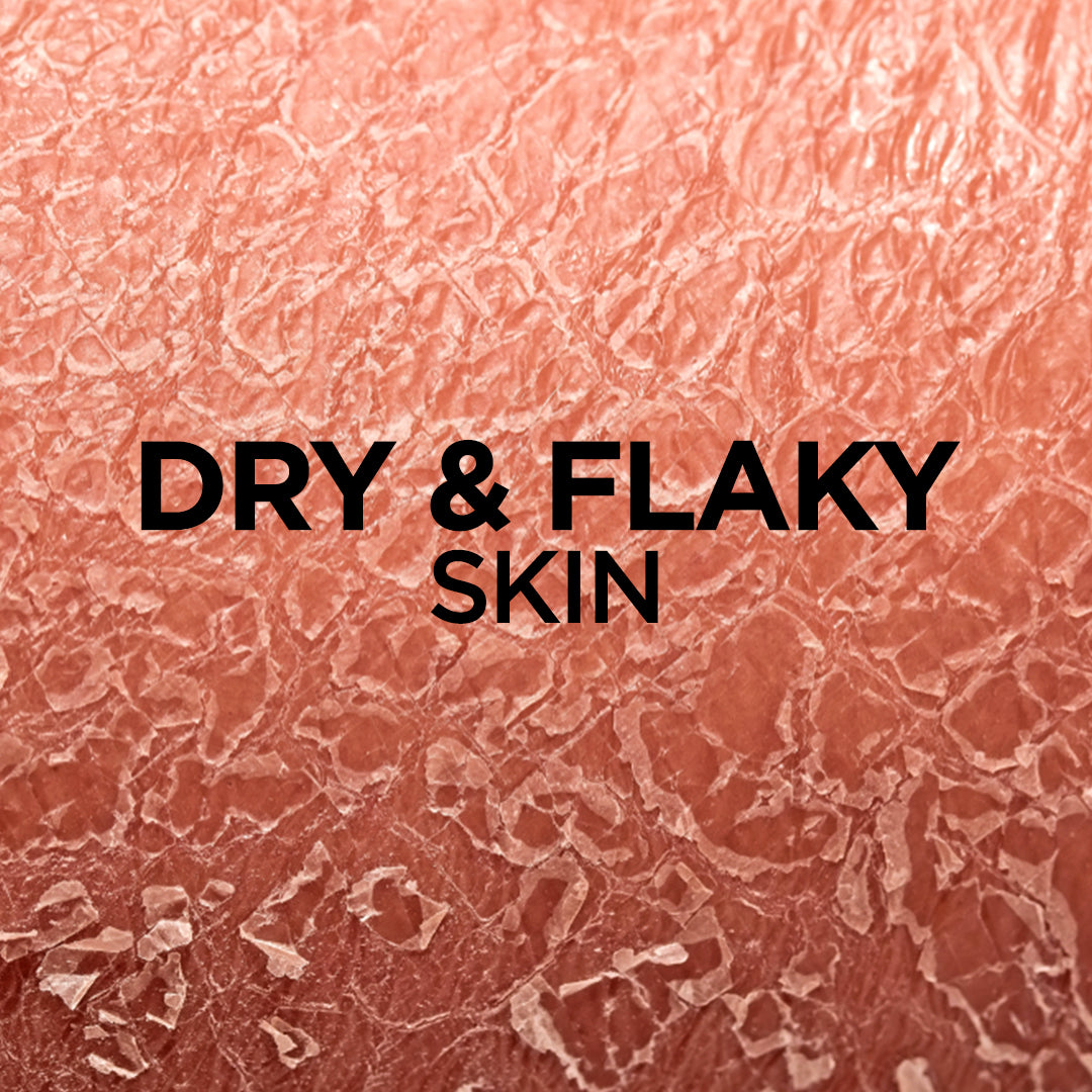 Dry & Flaky Skin
