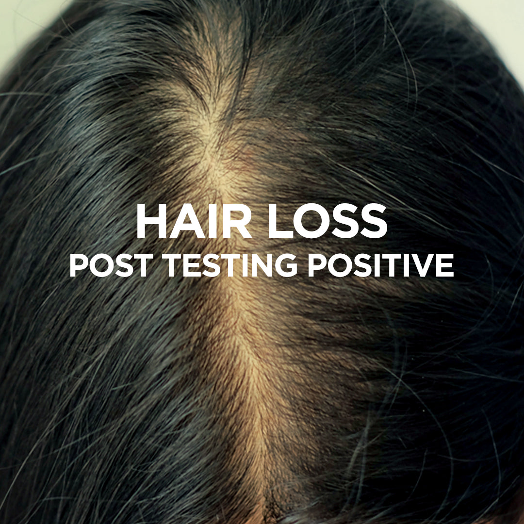 Hair Loss After Testing Positive