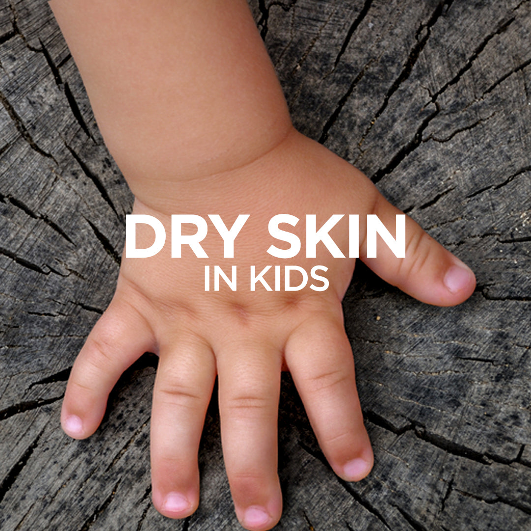 Dry Skin in Kids