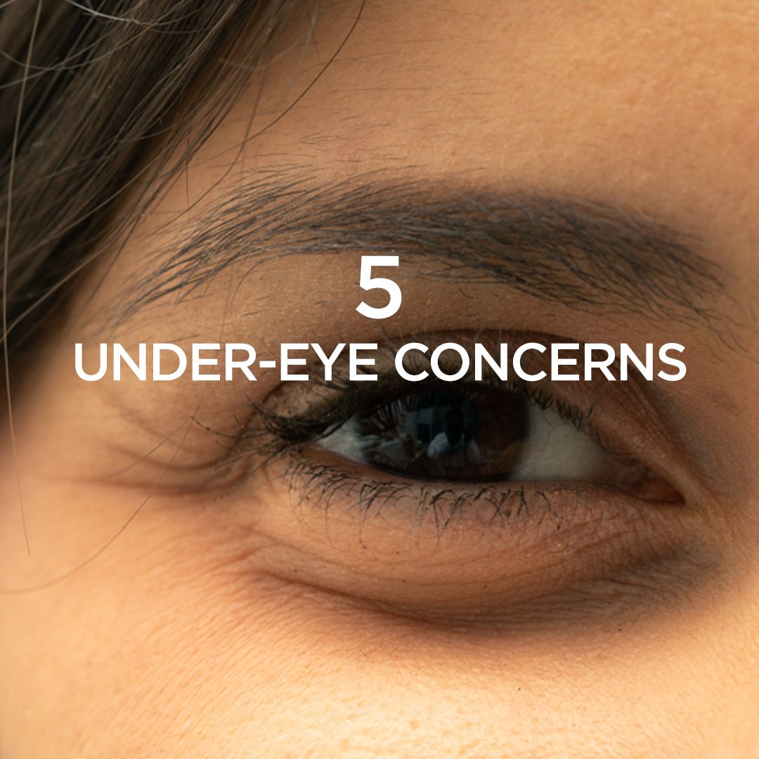 5 Under Eye Concerns 