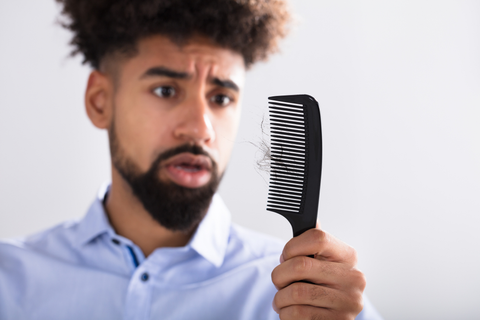 How To Control Hairfall in a 28 Year Old Male?