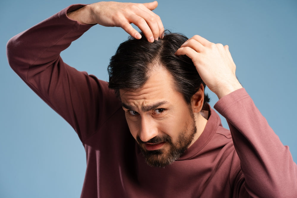 Top 10 Common Causes of Hair Loss in Men