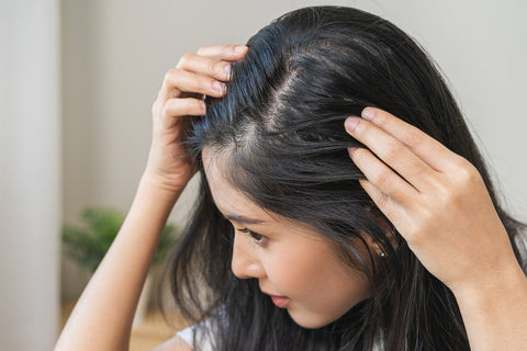 Understanding Hormonal Imbalance and Hair Fall