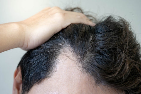 The Real Reason Your Hair Isn’t Growing? It Starts with Your Scalp