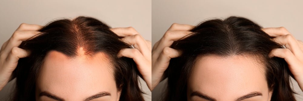 Hair Growth Tips
