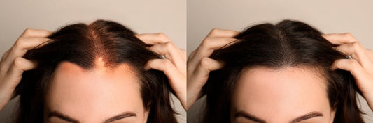 Hair Growth Tips