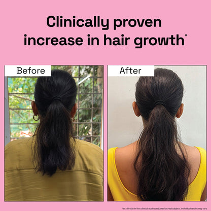 3X Rosemary Hair Growth Routine