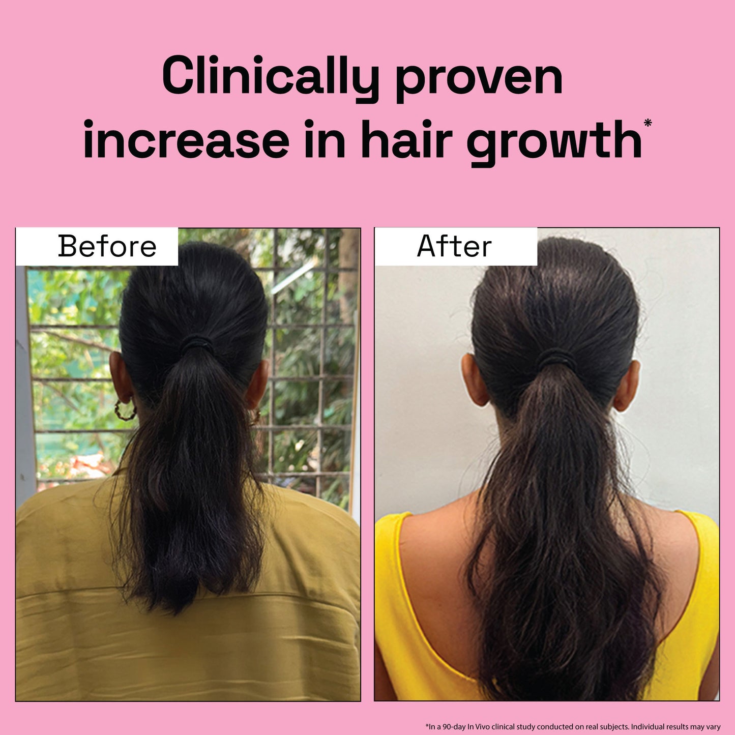 3X Rosemary for Hair Fall