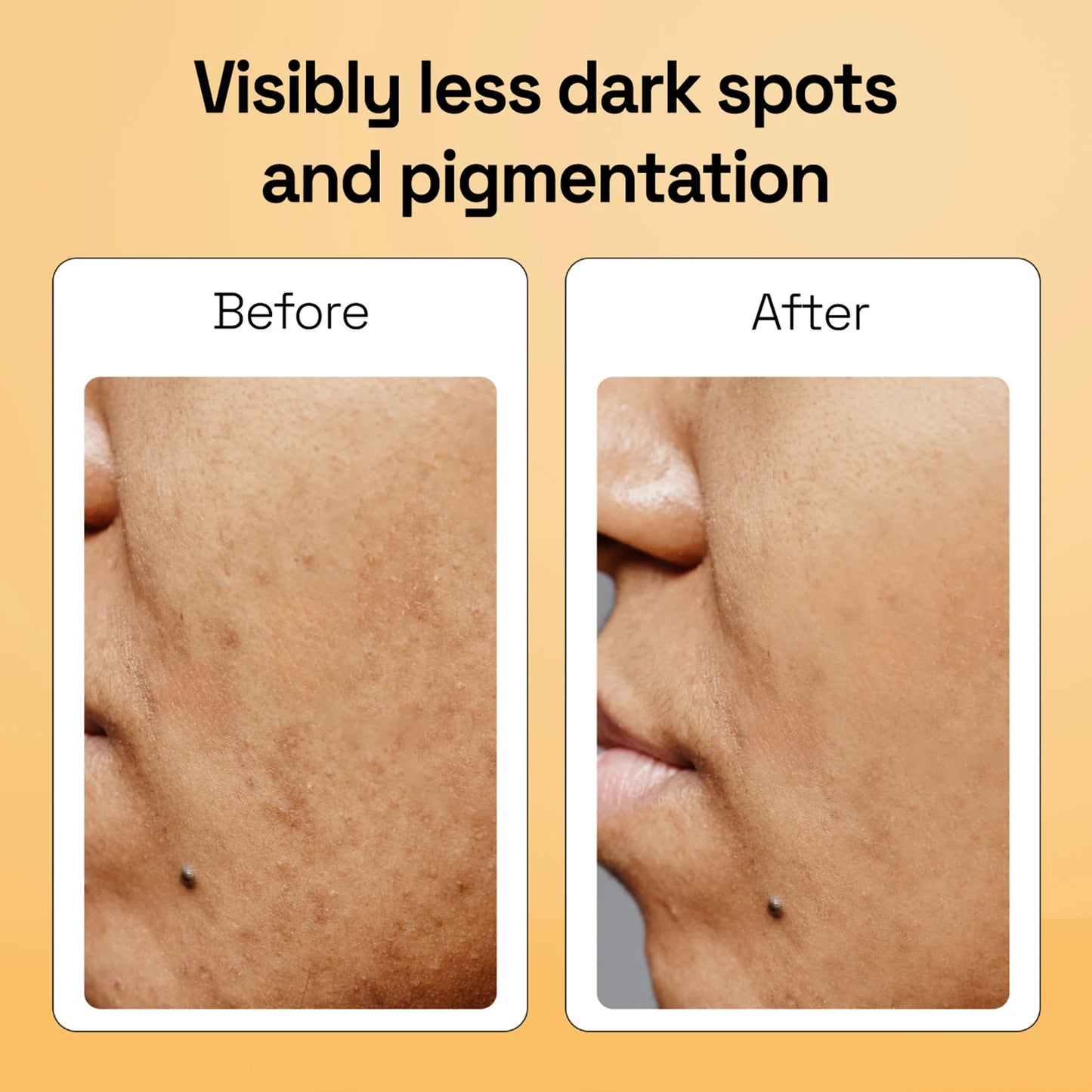 Kojic Acid Anti Pigmentation Kumkumadi Soap