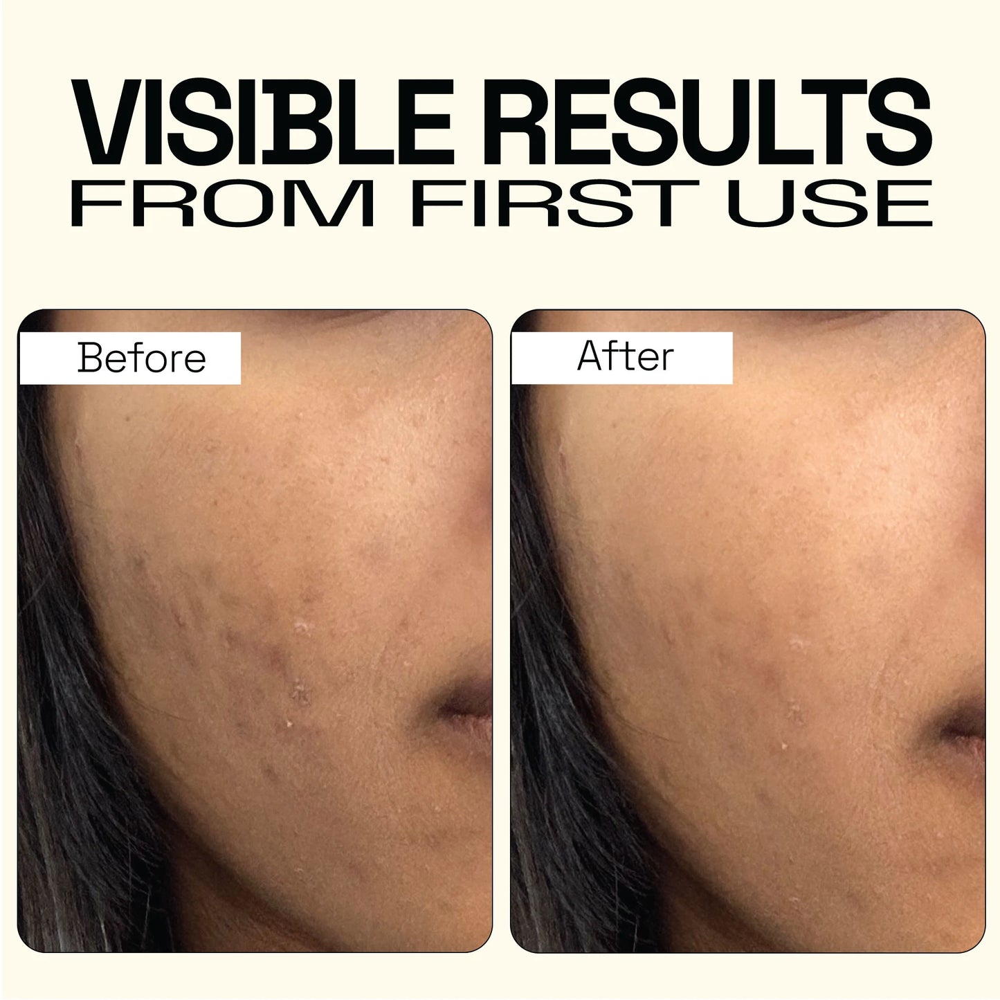 Deep Pores Cleansing & Brightening Ubtan Face Mask