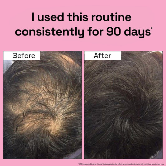 3X Rosemary Hair Growth Routine