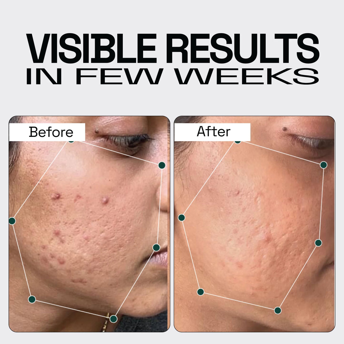 Vitamin C Serum for Bouncier & Brighter Skin