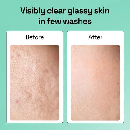 Niacinamide + Rice Water Soap