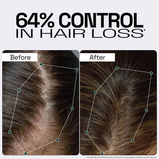 Rosemary Redensyl Hair Serum