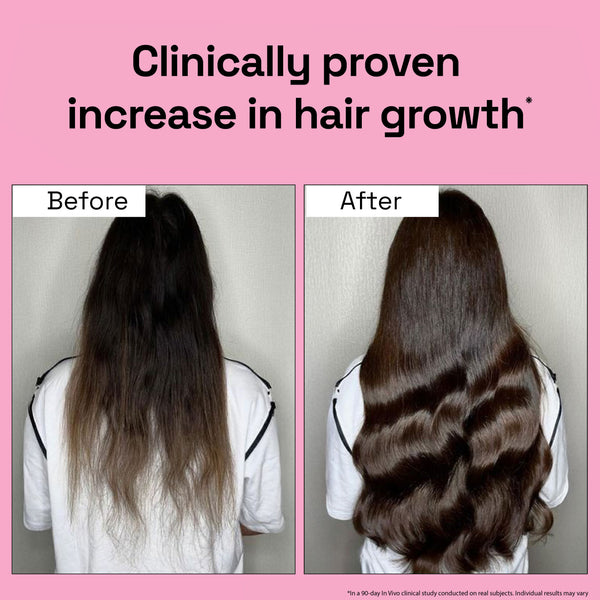 2X Rosemary for Hair Fall Control + Hair Growth Boost