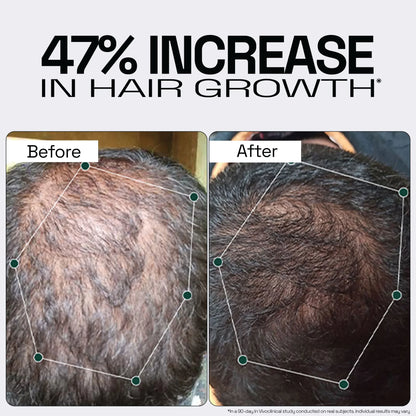 Rosemary Redensyl Hair Serum