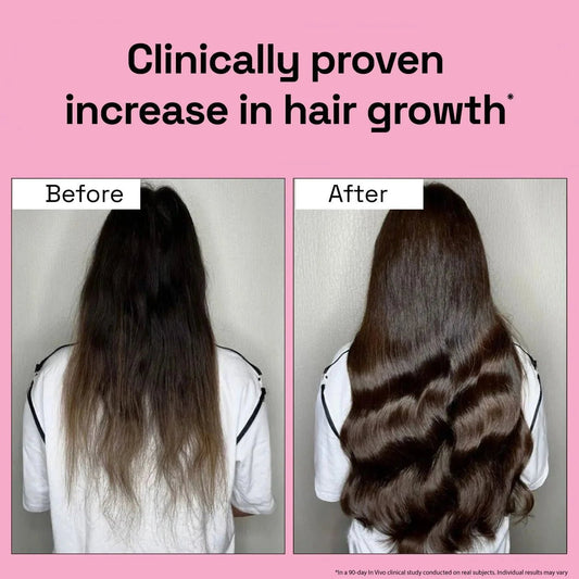 2X Rosemary Routine (Results from 1st Month)