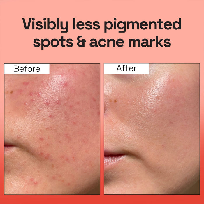 Vegan PDRN Spotless Gel Cleanser