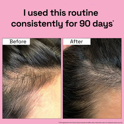 3X Rosemary Treatment with Hair Mask