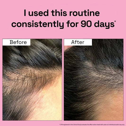 3X Rosemary Treatment with Hair Mask