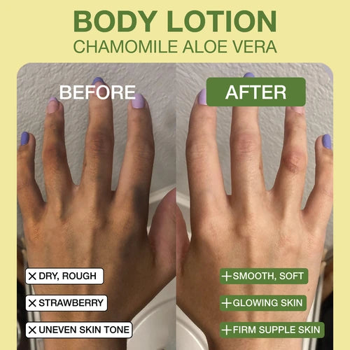 Before and after comparison of hands showing results of using Chamomile Aloe Vera Body Lotion, improving dry, rough, and uneven skin to smooth, glowing, and firm skin.