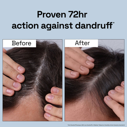 4-in-1 Daily Anti Shedding Dandruff Shampoo