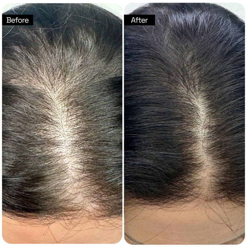 Before and after transformation 1