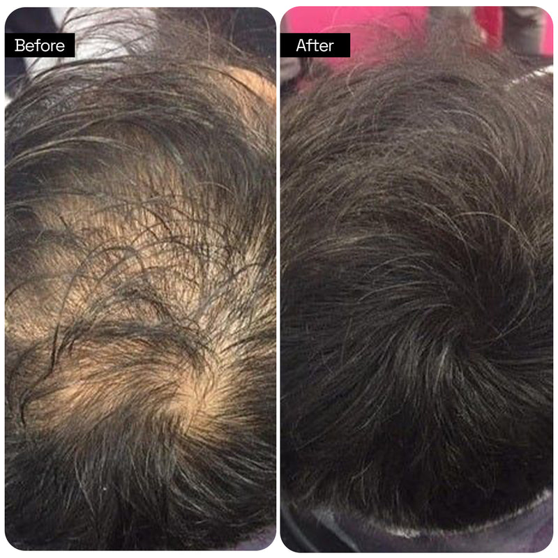Before and after transformation 2