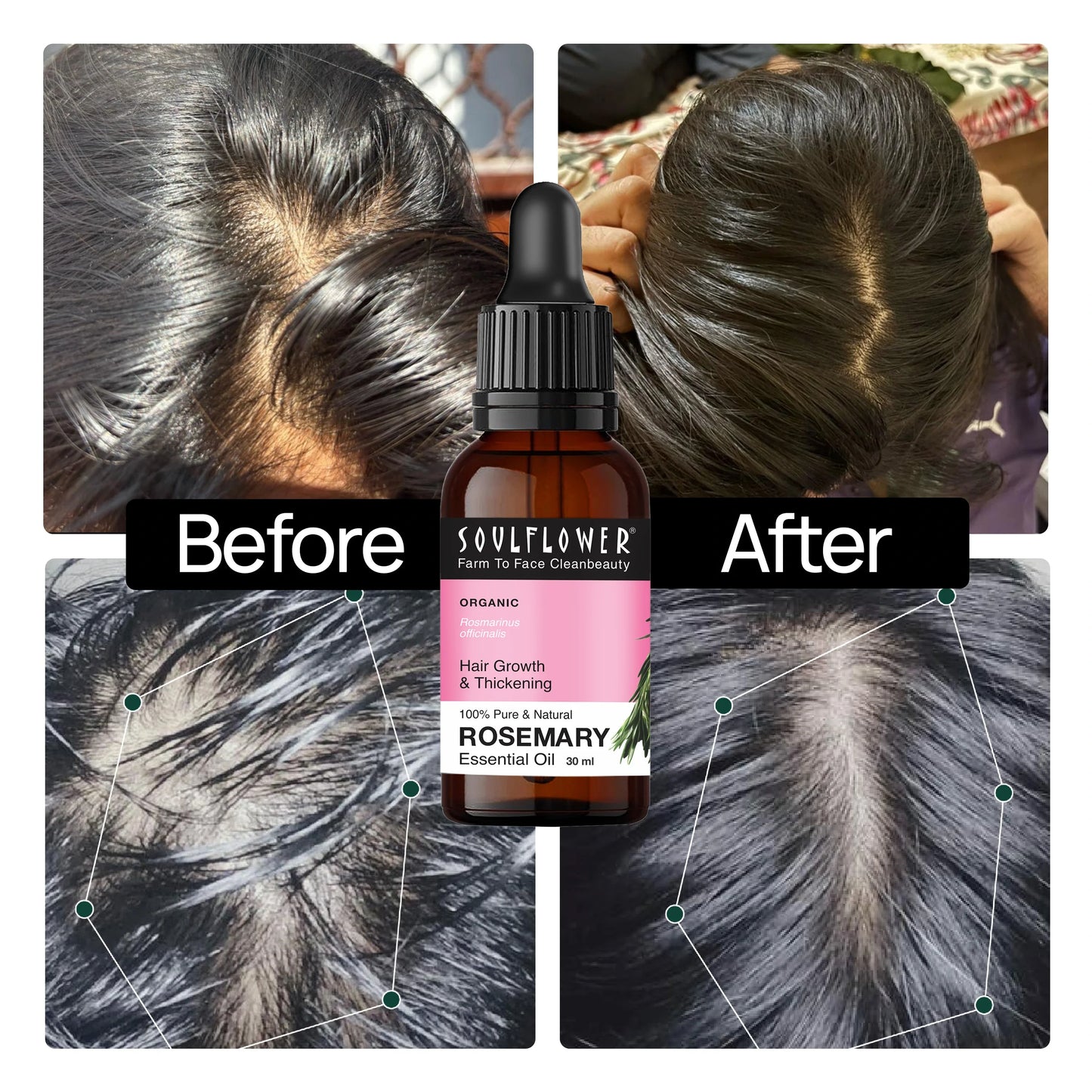 Clinically Tested Rosemary Essential Oil for Hair Growth (30ml * 3)