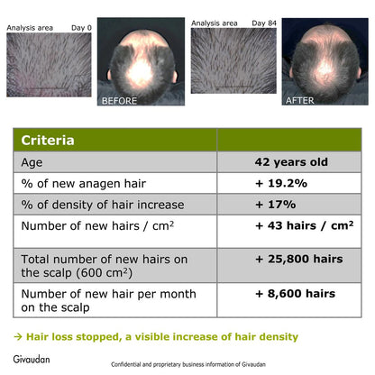 Rosemary Redensyl Hair Growth Serum