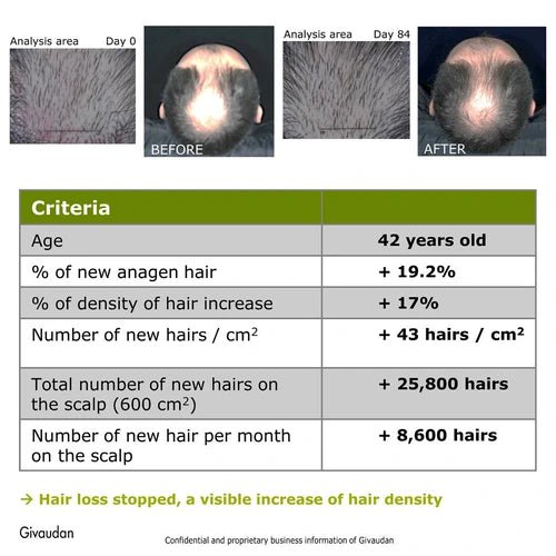 Stopped hair loss after using rosemary redensyl hair serum
