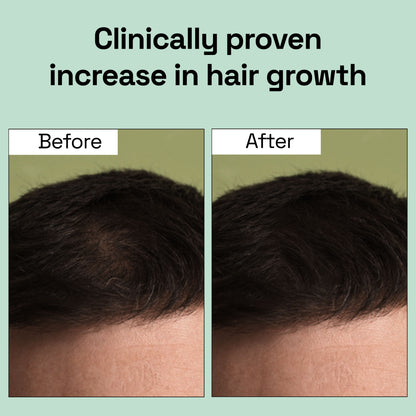 100% Pure & Natural Virgin Coconut Oil