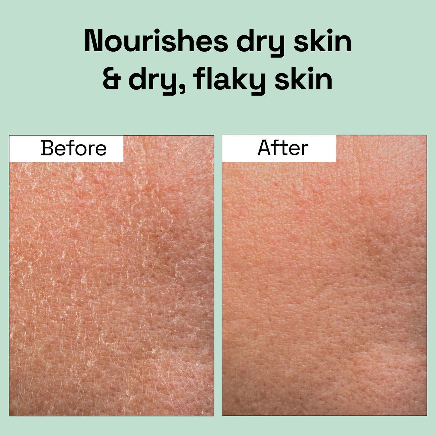 100% Pure & Natural Virgin Coconut Oil