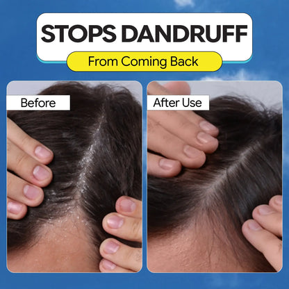 4-in-1 Daily Anti Shedding Dandruff Shampoo
