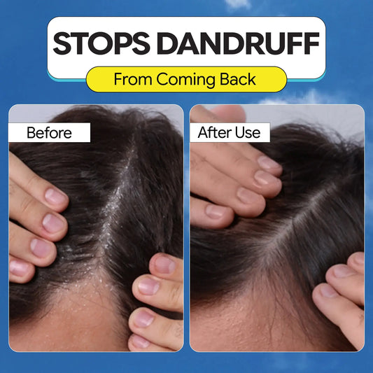 4-in-1 Daily Anti Shedding Dandruff Shampoo