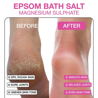 Before and after comparison of heel showing the effect of Epsom Bath Salt with magnesium sulphate, transforming dry, rough skin and sore joints into smooth skin, relaxed joints, and even skin tone.