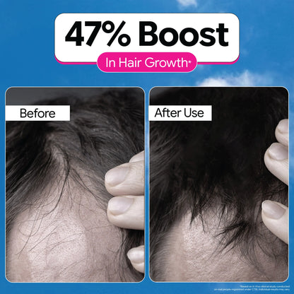 3X Rosemary Hair Growth Routine