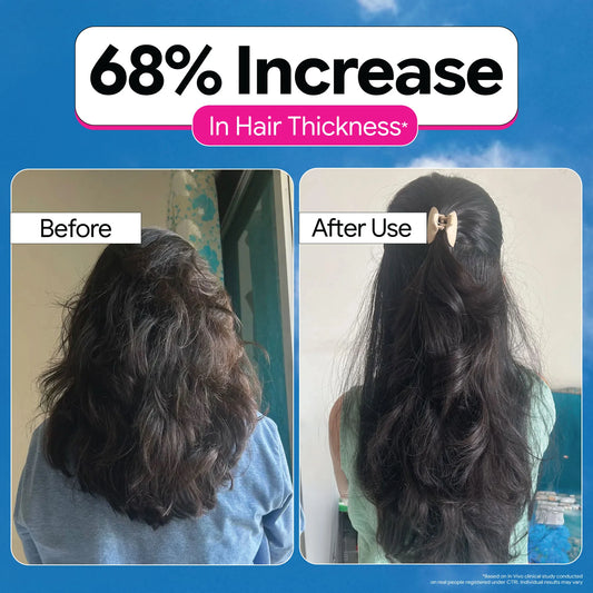 3X Rosemary Hair Growth Routine
