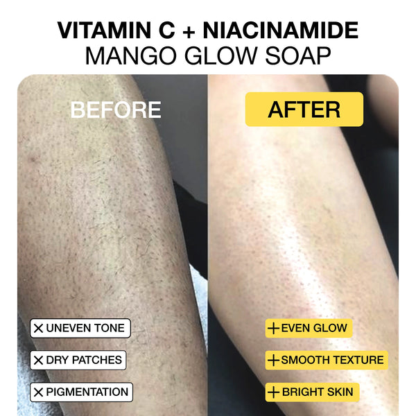 Niacinamide Mango Matcha Vitamin C Soap