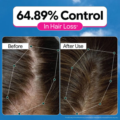 Rosemary Redensyl Hair Serum