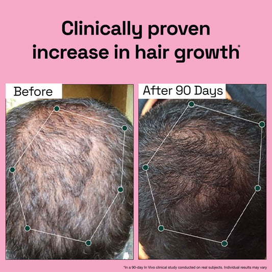 Rosemary Redensyl Hair Serum