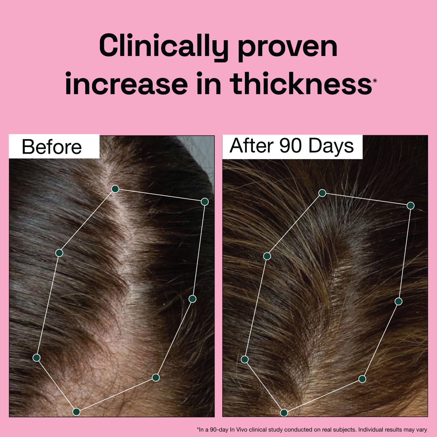 Rosemary Redensyl Hair Growth Serum