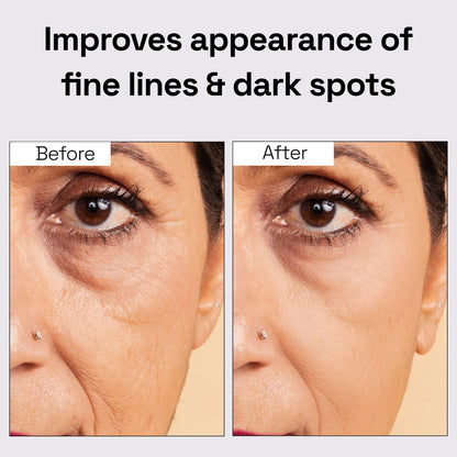 Rosehip Oil for Skin Hydration & Moisturization